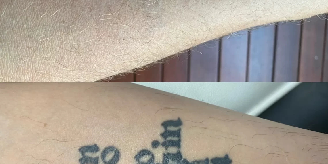 do you pee out tattoo ink